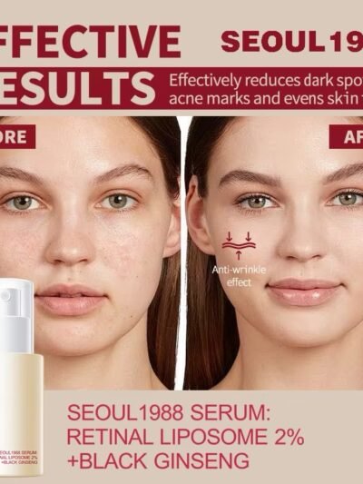 SEOUL 1988 Retinol Face Serum Fade Fine Wrinkle Moisturizing Whitening Remove Spot Shrink Pores Beauty Skin Care