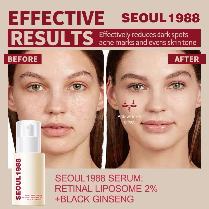 SEOUL 1988 Retinol Face Serum Fade Fine Wrinkle Moisturizing Whitening Remove Spot Shrink Pores Beauty Skin Care
